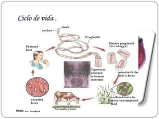 Cisticercosis parasitosis intestinal