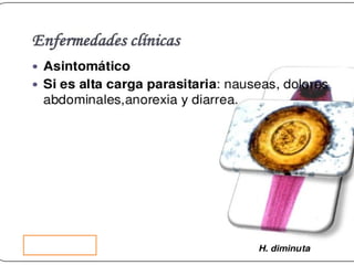Cisticercosis parasitosis intestinal