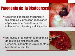 Patogenia de la Cisticercosis
 Lesiones por efecto mecánico y
toxialérgico y provocan reacciones
especialmente cuando mueren:
inflamación, fibrosis y calcificación.
 En músculo es común la presencia
de múltiples cisticercos con
Reacción inflamatoria circundante e
hipertrofia muscular.
 