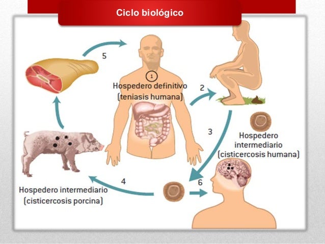 Cisticercosis Cisticercosis