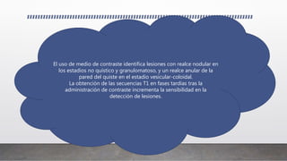 El uso de medio de contraste identifica lesiones con realce nodular en
los estadios no quístico y granulomatoso, y un realce anular de la
pared del quiste en el estadio vesicular-coloidal.
La obtención de las secuencias T1 en fases tardías tras la
administración de contraste incrementa la sensibilidad en la
detección de lesiones.
 