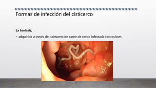 Formas de infección del cisticerco
La teniasis,
• adquirida a través del consumo de carne de cerdo infectada con quistes
 