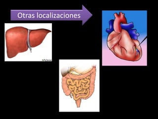 Otras localizaciones
 