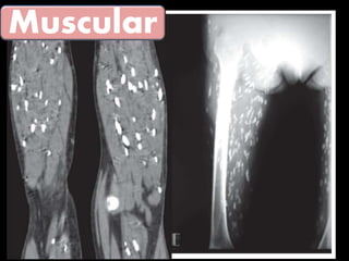 Muscular
 