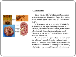 2.Calculii renali
Cistita netratată timp îndelungat favorizează
formarea calculilor, deoarece infecţia de la nivelul
vezicii urinare poate ascensiona pe uretere către
rinichi.
În timp, pe fondul unei alimentaţii bogate în
oxalaţi de calciu (se găsesc în legumele verzi şi în
ciocolată) şi al hidratării insuficiente, se formează
calculii renali. Dimensiunea unui calcul renal
variază de la cea a unui fir de nisip până la cea a
unui bob de mazăre.
Potrivit medicilor, o parte dintre calculii renali
ajung înapoi în uretră de unde, mai apoi, sunt
eliminaţi. Procesul de eliminare este deosebit de
dureros, deoarece calculii au margini atât netede,
cât şi colţuroase care zgârie pereţii căilor urinare
 