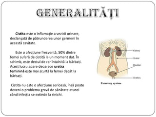 Cistita este o inflamaţie a vezicii urinare,
declanşată de pătrunderea unor germeni în
această cavitate.
Este o afecţiune frecventă, 50% dintre
femei suferă de cistită la un moment dat. În
schimb, este destul de rar întalnită la bărbaţi.
Acest lucru apare deoarece uretra
feminină este mai scurtă la femei decât la
bărbaţi.
Cistita nu este o afecţiune serioasă, însă poate
deveni o problema gravă de sănătate atunci
când infecţia se extinde la rinichi.
 