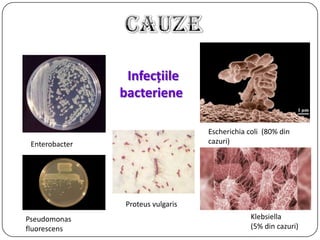 Infecţiile
bacteriene
Escherichia coli (80% din
cazuri)
Klebsiella
(5% din cazuri)
Enterobacter
Proteus vulgaris
Pseudomonas
fluorescens
 