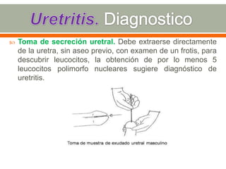    Toma de secreción uretral. Debe extraerse directamente
    de la uretra, sin aseo previo, con examen de un frotis, para
    descubrir leucocitos, la obtención de por lo menos 5
    leucocitos polimorfo nucleares sugiere diagnóstico de
    uretritis.
 