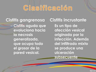 Cistitis gangrenosa
– Cistitis aguda que
evoluciona hacia
la necrosis
generalizada,
que ocupa todo
el grosor de la
pared vesical.
Cistitis incrustante
Es un tipo de
afección vesical
originada por la
infección. Además
del infiltrado mixto
se produce una
ulceración
subsecuente
 