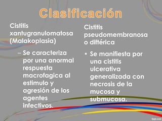 Cistitis
xantugranulomatosa
(Malakoplasia)
– Se caracteriza
por una anormal
respuesta
macrofagica al
estimulo y
agresión de los
agentes
infectivos.
Cistitis
pseudomembranosa
o diftérica
• Se manifiesta por
una cistitis
ulcerativa
generalizada con
necrosis de la
mucosa y
submucosa.
 