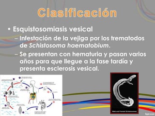 • Esquistosomiasis vesical
– Infestación de la vejiga por los trematodos
de Schistosoma haematobium.
– Se presentan con hematuria y pasan varios
años para que llegue a la fase tardía y
presenta esclerosis vesical.
 
