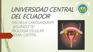 UNIVERSIDAD CENTRAL
DEL ECUADOR
MICAELA CARGUAQUISPE
SEGUNDO “B”
BIOLOGIA CELULAR
TEMA: CISTITIS
 
