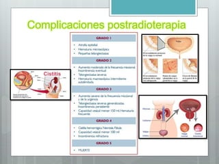 Complicaciones postradioterapia
 