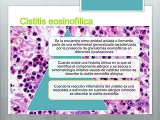 Cistitis eosinofílica
Se la encuentra como entidad aislada o formando
parte de una enfermedad generalizada caracterizada
por la presencia de granulomas eosinófilicos en
diferentes localizaciones
Cuando existe una historia clínica en la que se
identifica el componente alérgico y se asocia a
sintomatología irritativa vesical de carácter crónico se
describe la cistitis eosinófila alérgica
Cuando la reacción inflamatoria del urotelio es una
respuesta a estímulos sin sustrato alérgico conocido
se describe la cistitis eosinófila
 