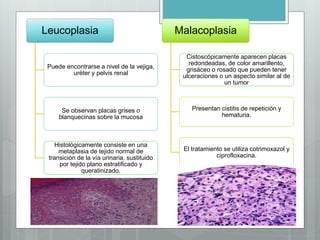 Leucoplasia
Puede encontrarse a nivel de la vejiga,
uréter y pelvis renal
Se observan placas grises o
blanquecinas sobre la mucosa
Histológicamente consiste en una
metaplasia de tejido normal de
transición de la vía urinaria, sustituido
por tejido plano estratificado y
queratinizado.
Malacoplasia
Cistoscópicamente aparecen placas
redondeadas, de color amarillento,
grisáceo o rosado que pueden tener
ulceraciones o un aspecto similar al de
un tumor
Presentan cistitis de repetición y
hematuria.
El tratamiento se utiliza cotrimoxazol y
ciprofloxacina.
 