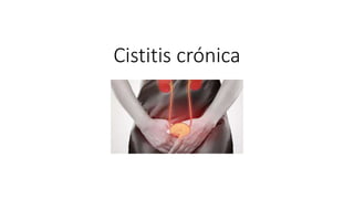 Cistitis crónica
 