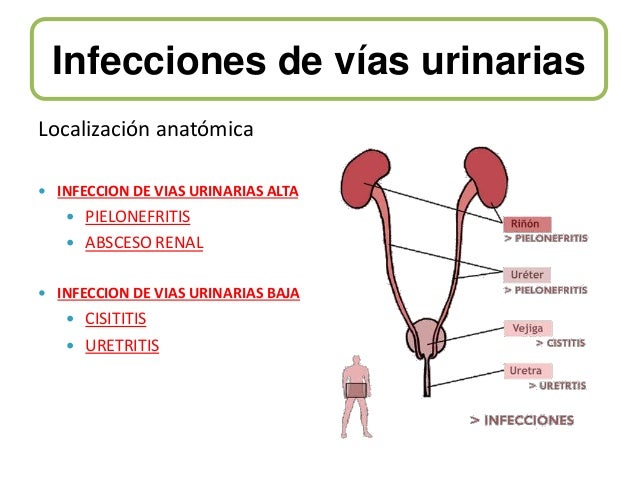 Cistitis y pielonefritis Cistitis y pielonefritis