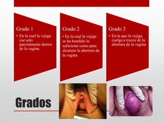 Grado 1                  Grado 2                   Grado 3
• En la cual la vejiga   • En la cual la vejiga    • En la que la vejiga
  cae solo               se ha hundido lo            cuelga a traves de la
  parcialmente dentro    suficiente como para        abertura de la vagina
  de la vagina           alcanzar la abertura de
                         la vagina




Grados
 