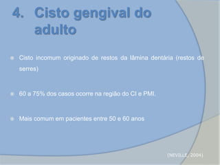  Cisto incomum originado de restos da lâmina dentária (restos de
serres)
 60 a 75% dos casos ocorre na região do CI e PMI.
 Mais comum em pacientes entre 50 e 60 anos
4. Cisto gengival do
adulto
(NEVILLE, 2004)
 