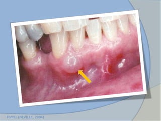 Fonte: (NEVILLE, 2004)
 