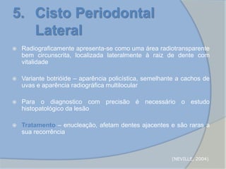 5. Cisto Periodontal
Lateral
 Radiograficamente apresenta-se como uma área radiotransparente
bem circunscrita, localizada lateralmente à raiz de dente com
vitalidade
 Variante botrióide – aparência policística, semelhante a cachos de
uvas e aparência radiográfica multilocular
 Para o diagnostico com precisão é necessário o estudo
histopatológico da lesão
 Tratamento – enucleação, afetam dentes ajacentes e são raras a
sua recorrência
(NEVILLE, 2004)
 