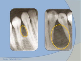 Fonte: (NEVILLE, 2004)
 