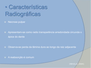  Necrose pulpar
 Apresentam-se como radio transparência arredondada circunda o
ápice do dente
 Observa-se perda da lâmina dura ao longo da raiz adjacente
 A reabsorção é comum
• Características
Radiográficas
(NEVILLE, 2004)
 