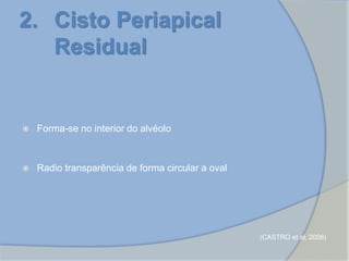  Forma-se no interior do alvéolo
 Radio transparência de forma circular a oval
2. Cisto Periapical
Residual
(CASTRO et al, 2008)
 