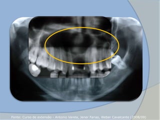 Fonte: Curso de extensão - Antonio Varela, Jener Farias, Weber Cavalcante (2008/09)
 