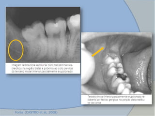 Fonte:(CASTRO et al, 2008)
 