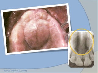 Fonte: (NEVILLE, 2004)
 