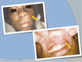 Fonte: (NEVILLE, 2004)
 