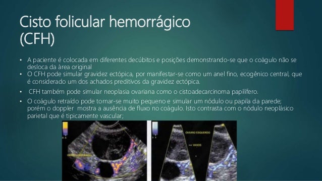 O Que É O Cisto Hemorrágico _ Compreendendo os cistos hemorrágicos – TZXPTR