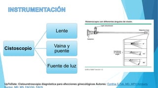 Cistoscopio
Lente
Vaina y
puente
Fuente de luz
UpToDate: Cistouretroscopia diagnóstica para afecciones ginecológicas Autores: Cynthia S Fok, MD, MPH Kimberly
 