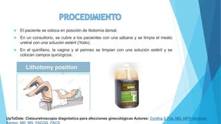  El paciente se coloca en posición de litotomía dorsal.
 En un consultorio, se cubre a los pacientes con una sábana y se limpia el meato
uretral con una solución estéril (Yodo).
 En el quirófano, la vagina y el perineo se limpian con una solución estéril y se
colocan campos quirúrgicos.
UpToDate: Cistouretroscopia diagnóstica para afecciones ginecológicas Autores: Cynthia S Fok, MD, MPH Kimberly
 