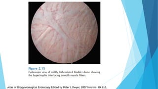 Atlas of Urogynecological Endoscopy Edited by Peter L Dwyer, 2007 Informa UK Ltd.
 