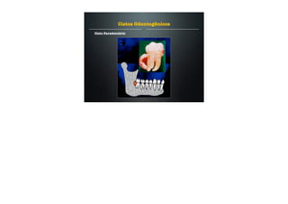 Cisto Paradentário
Cistos Odontogênicos
 