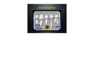 Cistos Odontogênicos
 