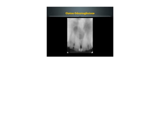 Cistos Odontogênicos
 