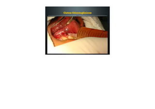 Cistos Odontogênicos
 