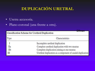 DUPLICACIÓN URETRAL

• Uretra accesoria.
• Plano coronal (una frente a otra).
                                       Effman
 