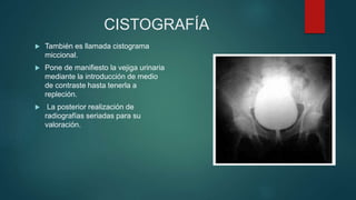 CISTOGRAFÍA
 También es llamada cistograma
miccional.
 Pone de manifiesto la vejiga urinaria
mediante la introducción de medio
de contraste hasta tenerla a
repleción.
 La posterior realización de
radiografías seriadas para su
valoración.
 