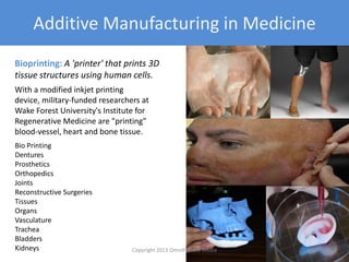 Bio Printing
Dentures
Prosthetics
Orthopedics
Joints
Reconstructive Surgeries
Tissues
Organs
Vasculature
Trachea
Bladders
Kidneys
With a modified inkjet printing
device, military-funded researchers at
Wake Forest University's Institute for
Regenerative Medicine are "printing"
blood-vessel, heart and bone tissue.
Bioprinting: A 'printer' that prints 3D
tissue structures using human cells.
Additive Manufacturing in Medicine
Copyright 2012 SparkFire Labs 29
 