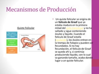 Mecanismos de Producción
• Un quiste folicular se origina de
un folículo de Graaf que ya
estaba maduro en la primera
mitad del ciclo menstrual y no ha
saltado y sigue conteniendo
óvulos y líquido. Cuando el
folículo de Graaf estalla
(ovulación), los óvulos entran en
la trompa de Falopio y pueden ser
fecundados. Si no hay
fecundación, el folículo de Graaf
se queda ahí y, si continúa
produciendo líquido, con lo cual
va ganando tamaño, acaba dando
lugar a un quiste folicular.
 