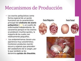Mecanismos de Producción
• Los ovarios poliquísticos como
forma especial de un quiste
funcional son la característica
principal del síndrome de ovario
poliquístico (SOP), un cuadro de
enfermedad independiente. Se
caracteriza porque en los ovarios
se producen muchos quistes, la
mayoría de los cuales son
relativamente pequeños.
• Los endometriomas tienen una
apariencia muy característica.
Contienen productos marrón
oscuro y espesos que proceden
del catabolismo de la sangre, por
lo que también se les
denomina quistes de chocolate.
 