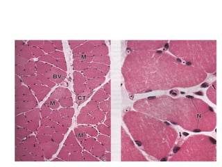 Músculo Estriado Esquelético - MO
 