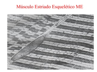 Músculo Estriado Esquelético ME
 