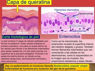 Capa de queratina
Corte histológico de piel
Epidermis
Dermis
Enterocitos
Filamentos intermedios
Desmosomas
Desmosomas
La piel contiene 5 capas de células epiteliales que
forman la epidermis. Estas células sintetizan la
proteína queratina, una parte se queda dentro de
las células para formar a los filamentos intermedios
para darles resistencia y la otra parte exocita a la
superficie de la piel para protegerla. Profundo a la
epidermis está la dermis, en donde ya hay
capilares sanguíneos, terminaciones nerviosas y
otras estructuras.
Como se ha mencionado, los
enterocitos revisten la superficie interna
del intestino delgado y grueso. También
forman filamentos intermedios que van
conectando a las células en los
desmosomas, como lo esquematizo en
la imagen que se muestra. Así,
proporciona resistencia a estas células.
Hay un padecimeinto en humanos llamado Epidermólisis ampular simple
Enfermedad de humanos por mutación del gen de la queratina
 