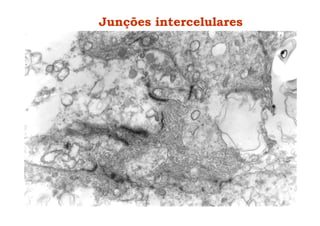 Junções intercelulares
 