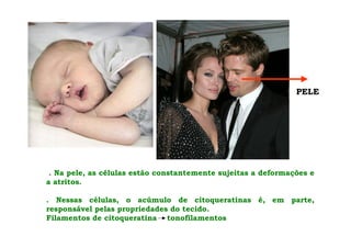 . Na pele, as células estão constantemente sujeitas a deformações e
a atritos.
. Nessas células, o acúmulo de citoqueratinas é, em parte,
responsável pelas propriedades do tecido.
Filamentos de citoqueratina tonofilamentos
PELE
 